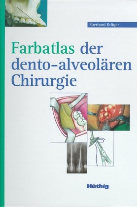 Farbatlas der dento-alveol&auml;ren Chirurgie - Eberhard Kr&uuml;ger