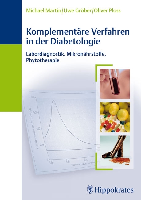 Komplement&auml;re Verfahren in der Diabetologie - Michael Martin, Uwe Gr&ouml;ber, Oliver Ploss