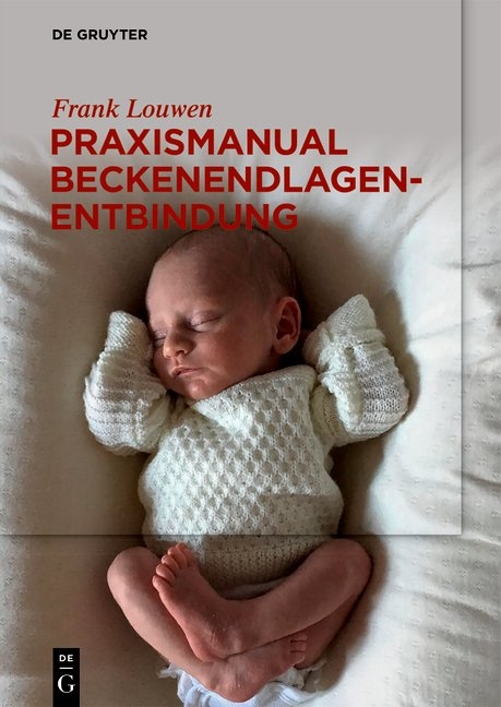 Praxismanual Beckenendlagenentbindung - Frank Louwen