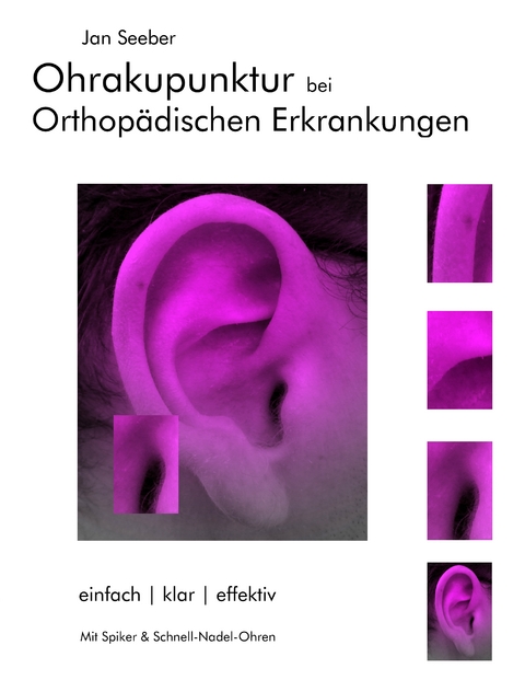 Ohrakupunktur bei Orthop&auml;dischen Erkrankungen - Jan Seeber