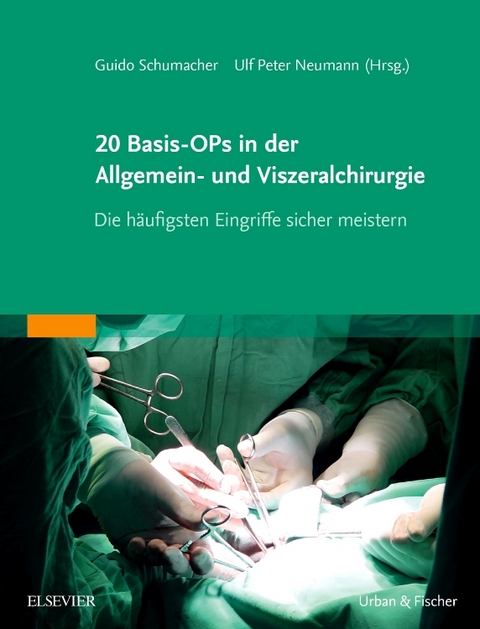 20 Basis-OPs in der Allgemein- und Viszeralchirurgie - 