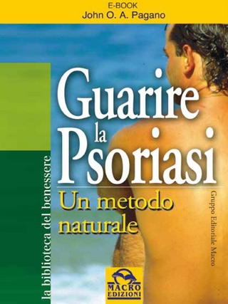 Guarire la psoriasi