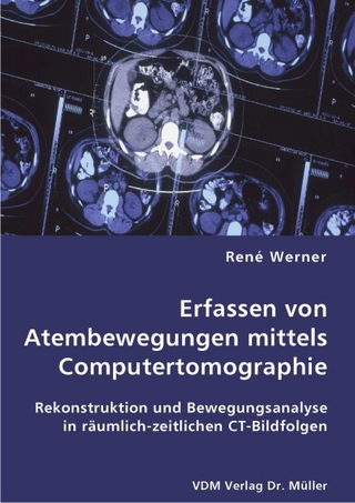 Erfassen von Atembewegungen mittels Computertomographie