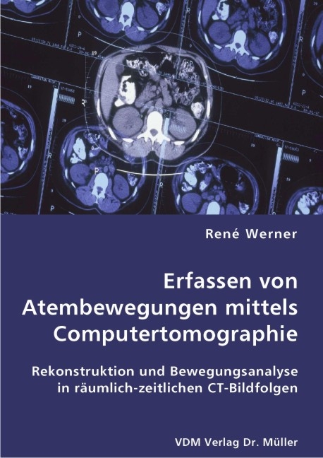 Erfassen von Atembewegungen mittels Computertomographie - Ren&eacute; Werner