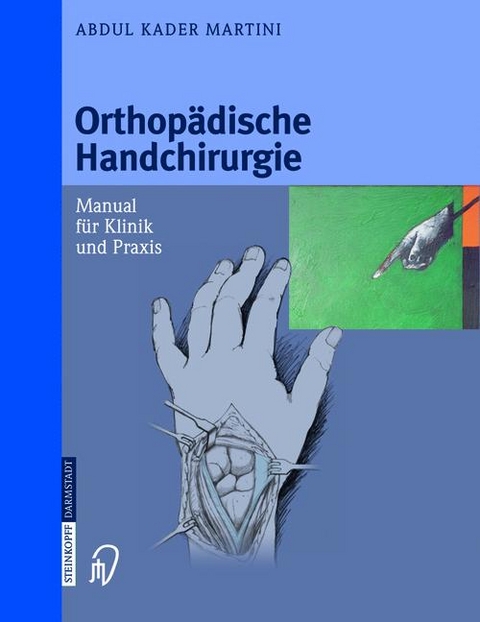 Orthop&auml;dische Handchirurgie - A. K. Martini