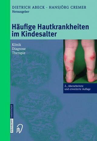 Häufige Hautkrankheiten im Kindesalter