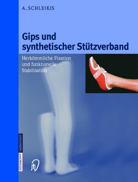 Gips und synthetischer St&uuml;tzverband - Adolf Schleikis