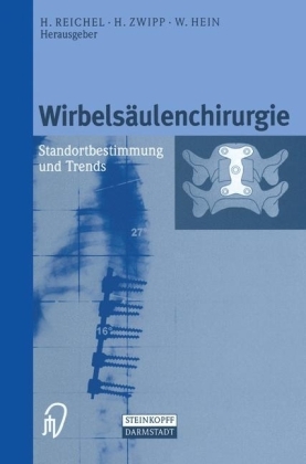 Wirbelsäulenchirurgie - 