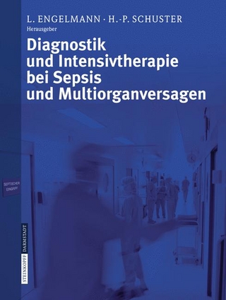 Diagnostik und Intensivtherapie bei Sepsis und Multiorganversagen