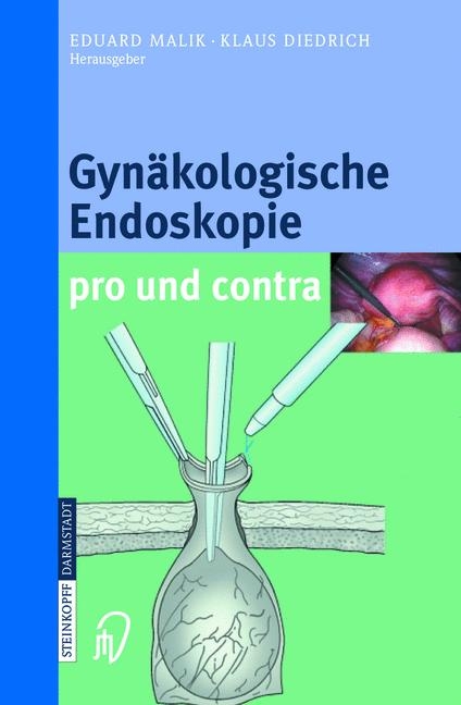 Gyn&auml;kologische Endoskopie pro und kontra - 