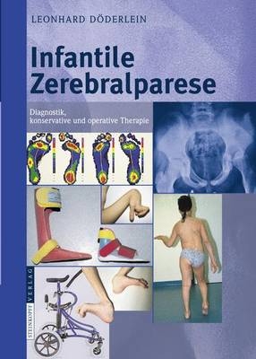 Infantile Zerebralparese - L. D&ouml;derlein