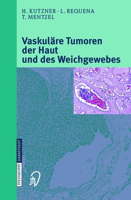 Vaskul&auml;re Tumoren der Haut und des Weichgewebes - H. Kutzner, L. Requena, T. Mentzel