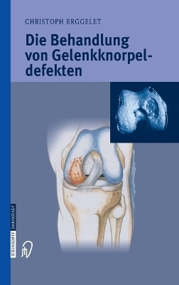 Die Behandlung von Gelenkknorpeldefekten