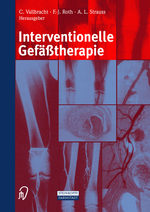 Interventionelle Gef&auml;&szlig;therapie - 