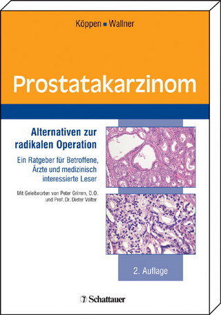Prostatakarzinom