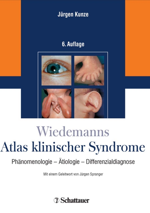Wiedemanns Atlas klinischer Syndrome - J&uuml;rgen Kunze