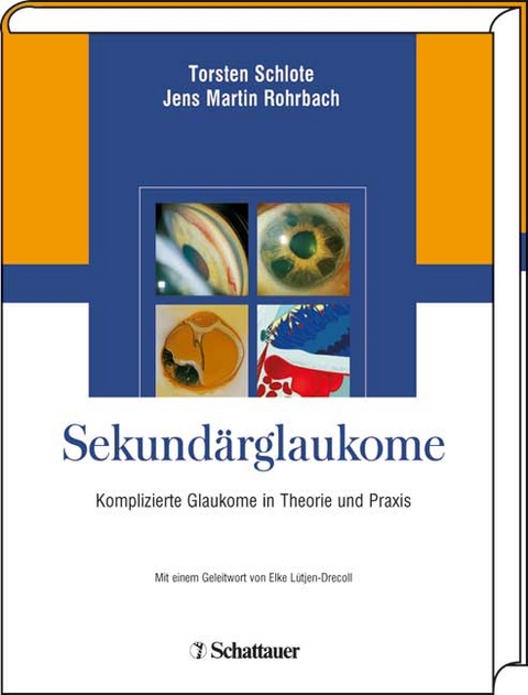 Sekund&auml;rglaukome - 