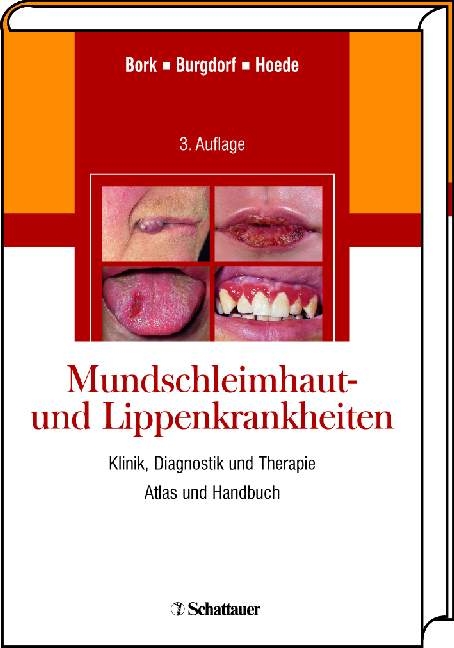 Mundschleimhaut- und Lippenkrankheiten - Konrad Bork, Walter Burgdorf, Nikolaus Hoede