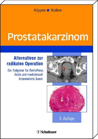 Prostatakarzinom