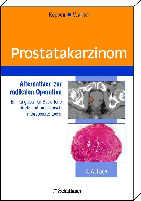 Prostatakarzinom - Ulrich K&ouml;ppen, Kent Wallner