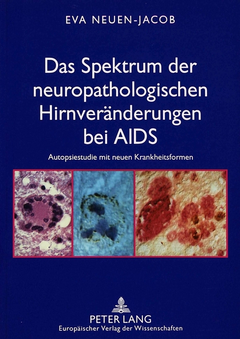 Das Spektrum der neuropathologischen Hirnver&auml;nderungen bei AIDS - Eva Neuen-Jacob