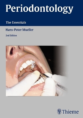 Periodontology - Hans-Peter M&uuml;ller