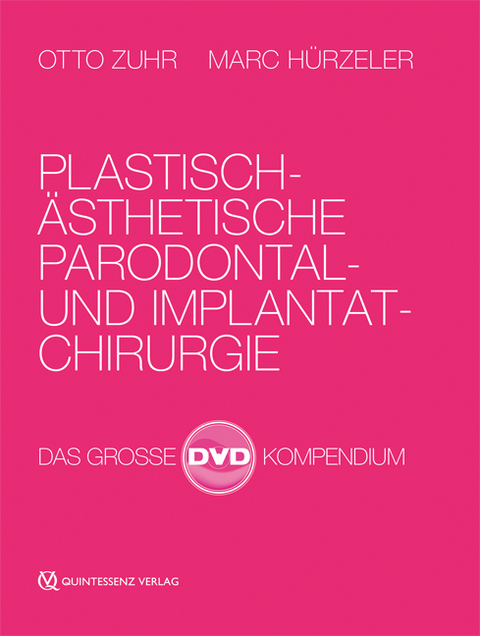 Plastisch-&Auml;sthetische Parodontal- und Implantatchirurgie - Otto Zuhr, Marc H&uuml;rzeler