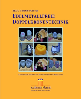 Edelmetallfreie Doppelkronentechnik