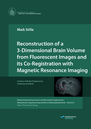 Reconstruction of a 3-Dimensional Brain Volume from Fluorescent Images and its Co-Registration with Magnetic Resonance Imaging