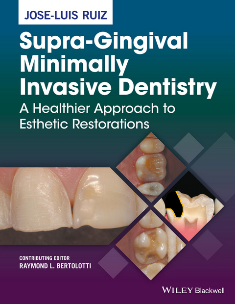 Supra-Gingival Minimally Invasive Dentistry - Jose-Luis Ruiz