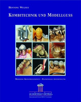 Kombitechnik und Modellguss: Ein Leitfaden