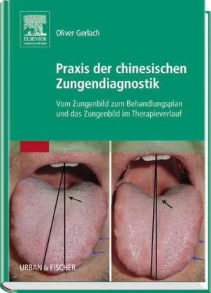 Praxis der chinesischen Zungendiagnostik