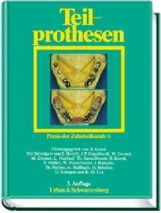 Teilprothesen - 
