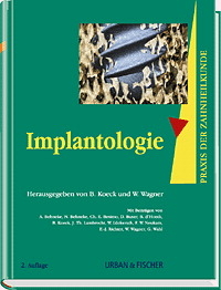 Praxis der Zahnheilkunde - PdZ. Strukturiert nach dem PermaNova-Verfahren / Implantologie - 