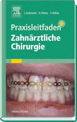 Praxisleitfaden Zahn&auml;rztliche Chirurgie - Jochen Jackowski, Hajo Peters, Frank H&ouml;lzle