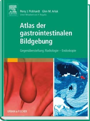 Atlas der gastrointestinalen Bildgebung - Perry J Pickhardt, Glen M Arluk