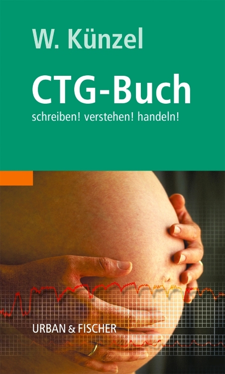 Das CTG-Buch - Wolfgang K&uuml;nzel