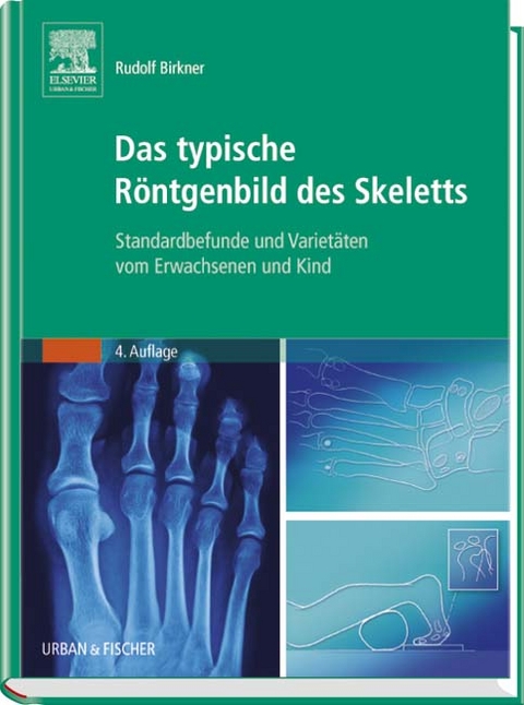 Das typische R&ouml;ntgenbild des Skeletts - Rudolf Birkner
