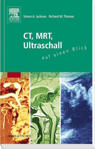 CT, MRT, Ultraschall auf einen Blick