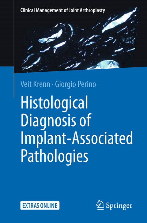 Histological Diagnosis of Implant-associated Pathologies - Veit Krenn, Giorgio Perino