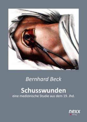 Schusswunden - Bernhard Beck