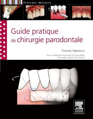 Guide Pratique de Chirurgie Parodontale