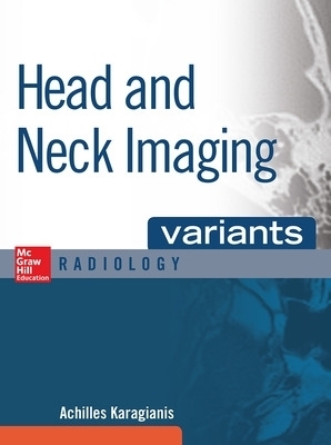 Head and Neck Imaging Variants - Achilles Karagianis