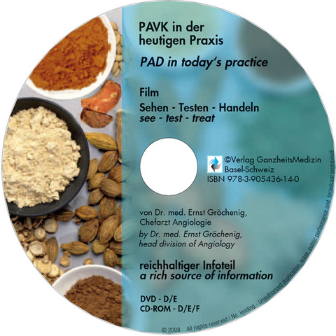 PAVK in der heutigen Praxis /PAD in today's practice