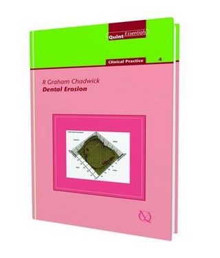 Dental Erosion