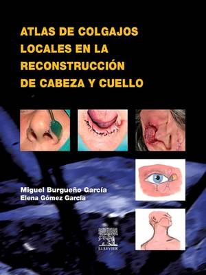 Atlas de Colgajos Locales En La Reconstrucci&oacute;n de Cabeza Y Cuello - Miguel Burgue&ntilde;o Garc&iacute;a, Elena Milagros G&oacute;mez Garc&iacute;a