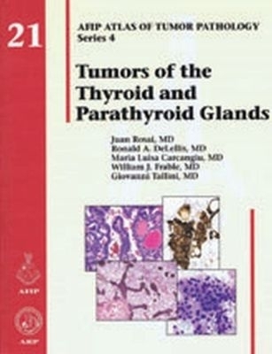 Tumors of the Thyroid and Parathyroid Glands