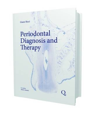 Periodontal Diagnosis and Therapy