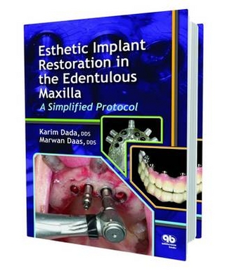 Esthetic Implant Restoration in the Edentulous Maxilla