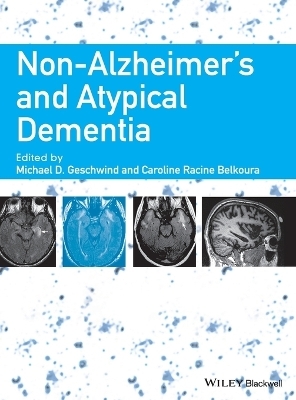 Non-Alzheimer's and Atypical Dementia - 
